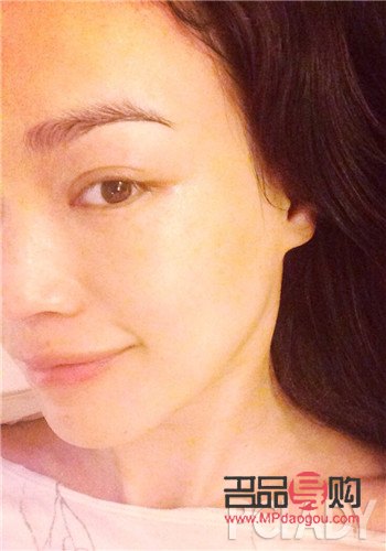 告别浮肿眼袋，重拾明亮双眸