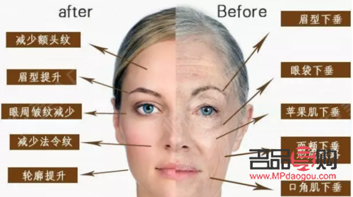 <h3>针雕美容：重塑容颜，效果究竟如何？</h3>