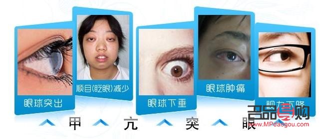 甲亢突眼能做手术吗(甲亢突眼能做手术吗?)