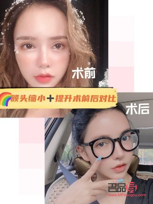 美容一管管用吗(美容一次大概多少钱)