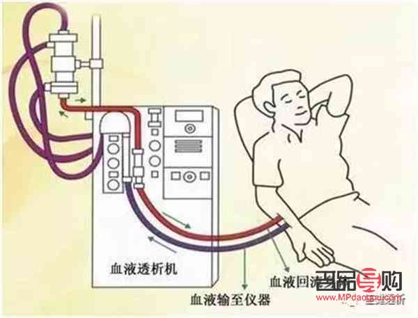 美容院透析是什么(美容院透析是什么原因)