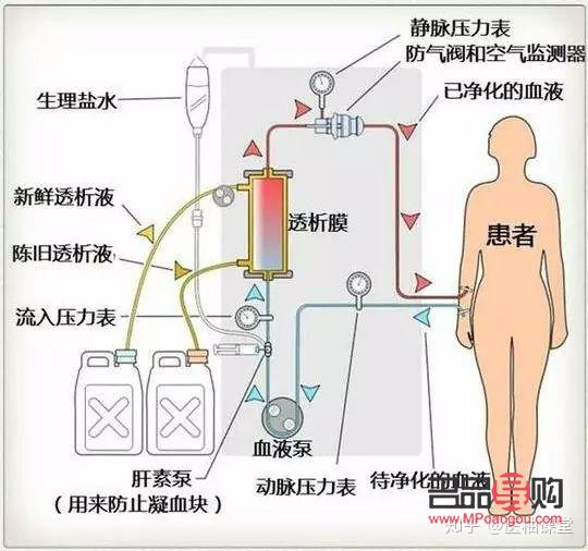 美容院透析是什么(美容院透析是什么原因)