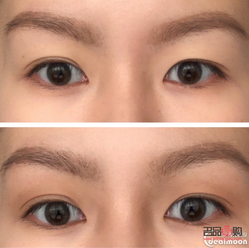 <h3>内双肿眼泡的消除秘诀</h3> <h3>内双肿眼泡的消除秘诀</h3>