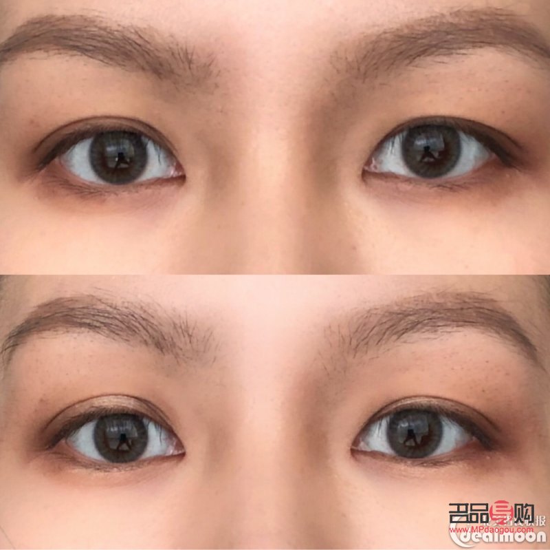 <h3>内双肿眼泡的消除秘诀</h3> <h3>内双肿眼泡的消除秘诀</h3>