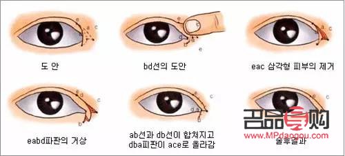 双眼皮的魅力：探寻其在全球的分布与受欢迎程度