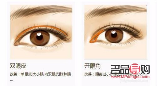 眼角下垂有什么办法可以调整的(眼角下垂有什么办法可以调整的小孩)