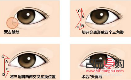 眼角下垂有什么办法可以调整的(眼角下垂有什么办法可以调整的小孩)