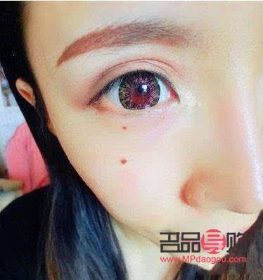 <h3>女人长痣怎么美容</h3>