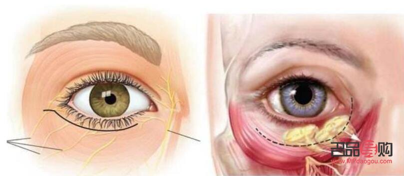 内切眼袋手术需要多长时间(内切眼袋手术需要多长时间恢复)