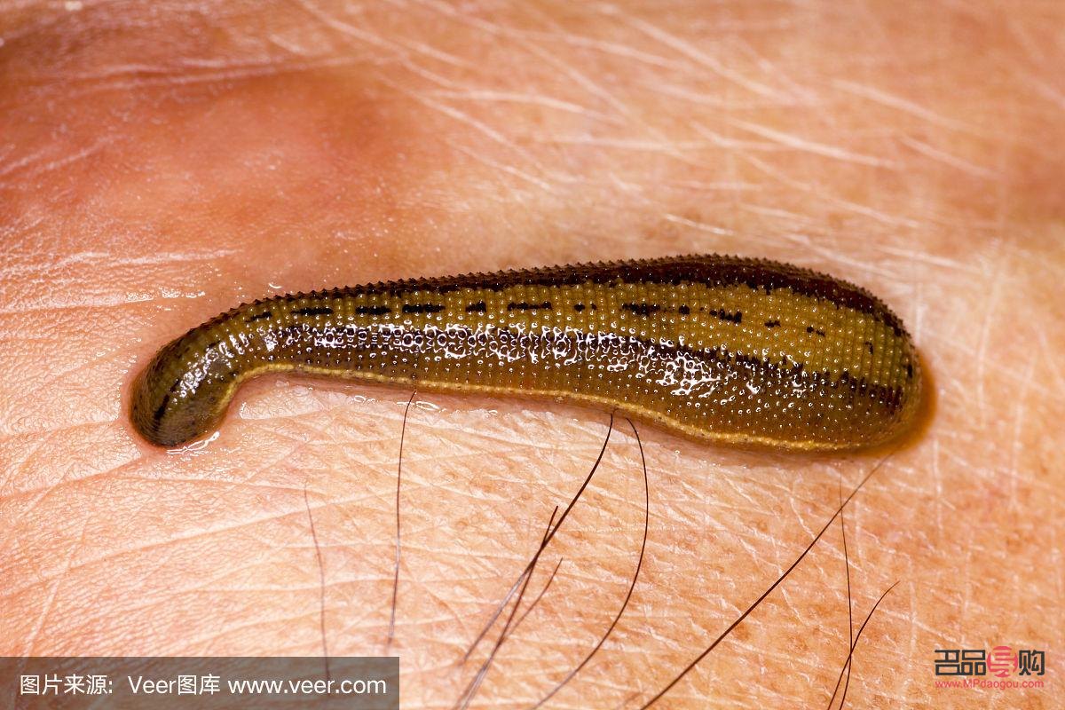 水蛭怎么美容(水蛭怎么美容效果好)