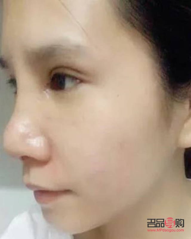 眼综合跟全切有啥区别(眼综合跟全切有什么区别) 眼综合跟全切有啥区别(眼综合跟全切有什么区别)