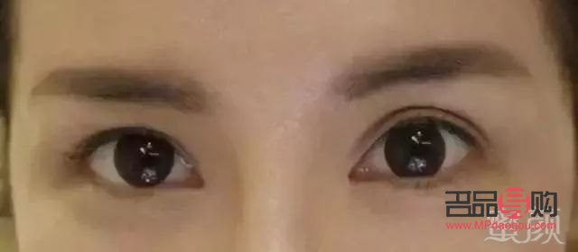 春秋两季，双眼皮成形的最佳时机