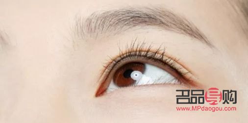 <h3>割双眼皮手术后的恢复期需多久？</h3>