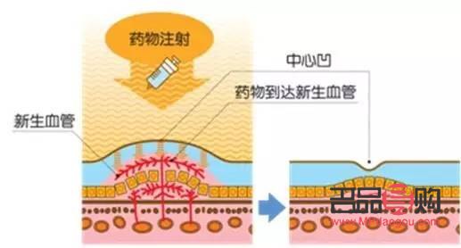 眼疗的作用与功效的广告语有哪些(眼疗的作用与功效的广告语有哪些呢)