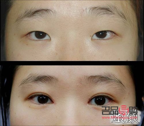 <h1>双眼皮魅力之谜:外双与内双边的独特组合</h1> <h1>双眼皮魅力之谜:外双与内双边的独特组合</h1>