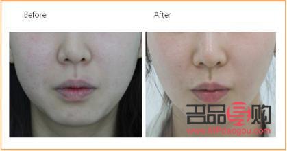 <h3>激光美容：真的有效吗？</h3>