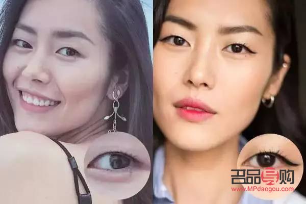 <h3>重塑青春明眸：眼皮松弛的恢复之道</h3>