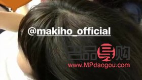 <h3>唇裂能否进行美容修复？</h3>