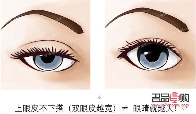 上眼皮松弛恢复锻炼法(上眼皮松弛恢复锻炼法图片)