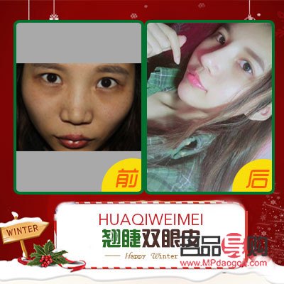 西安眼部整形医生预约(西安眼部整形医生预约挂号)