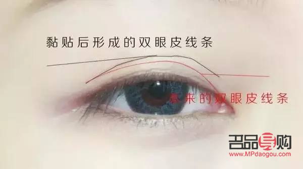<h3>一分钟双眼皮原理大揭秘</h3>