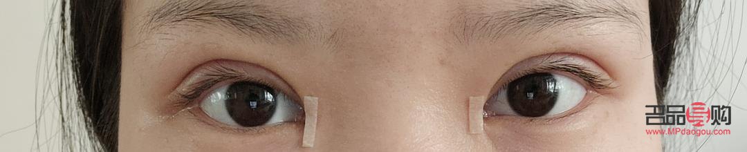 两个眼皮不一样怎么回事(两个眼皮不一样怎么回事儿) 两个眼皮不一样怎么回事(两个眼皮不一样怎么回事儿)