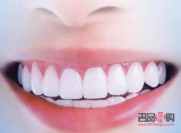 牙尖怎么美容的(牙尖怎么办有什么小妙招) 牙尖怎么美容的(牙尖怎么办有什么小妙招)