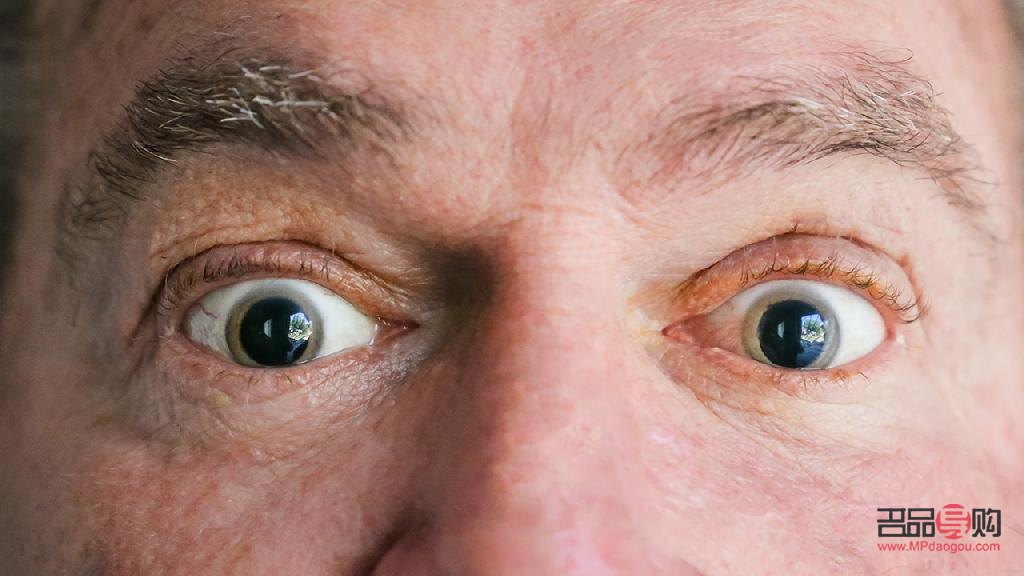 视神经萎缩：一只眼睛幸免于难