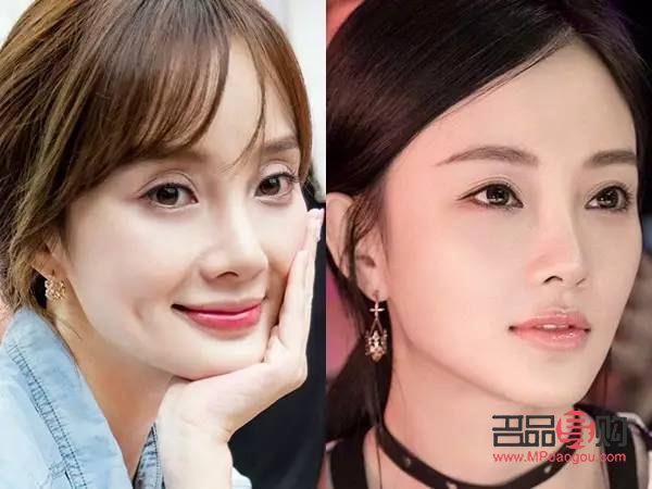 双眼皮成功的案例有哪些(双眼皮成功的案例有哪些)