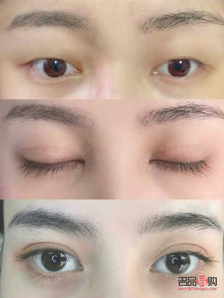 哪里双眼皮好啊(哪里双眼皮好啊女生)