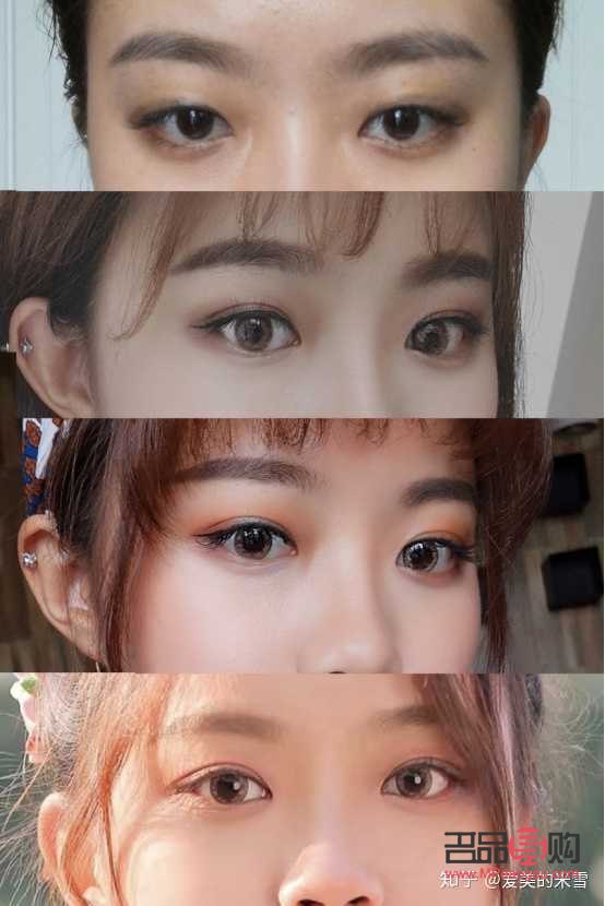 哪里双眼皮好啊(哪里双眼皮好啊女生)