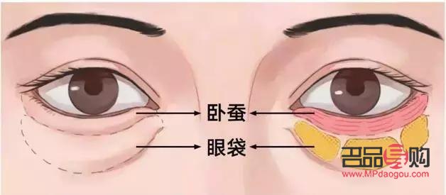 泪沟和眼袋有啥区别(泪沟和眼袋有啥区别呢)