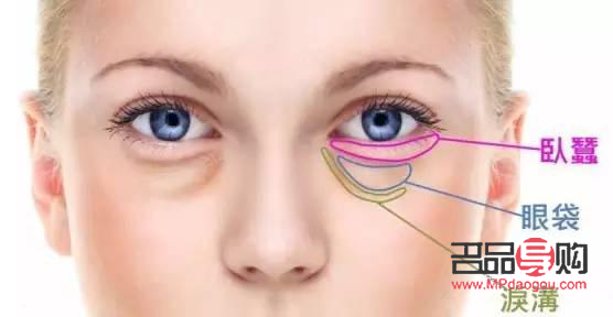 泪沟和眼袋有啥区别(泪沟和眼袋有啥区别呢)