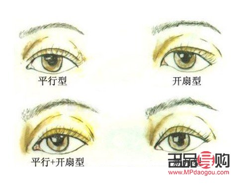 双眼皮宽了怎么补救视频(双眼皮宽了怎么补救视频教程)