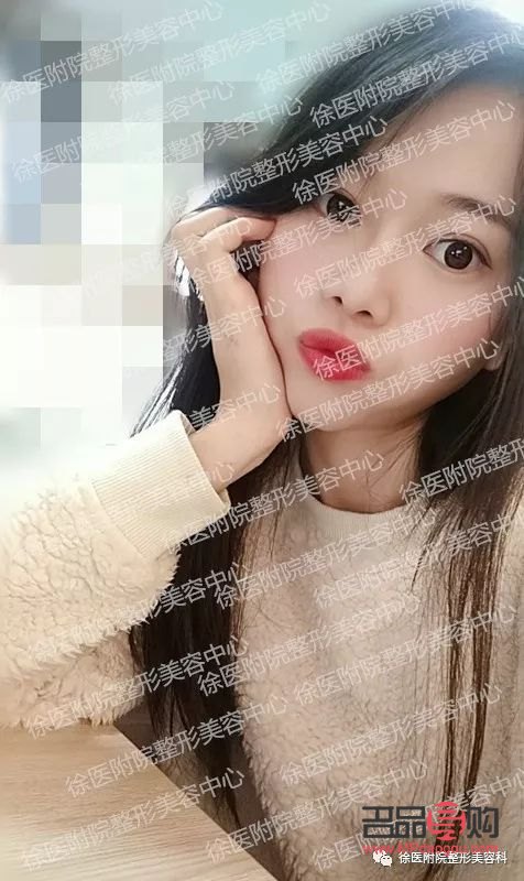 怎么美容整容(怎么美容整容好看)