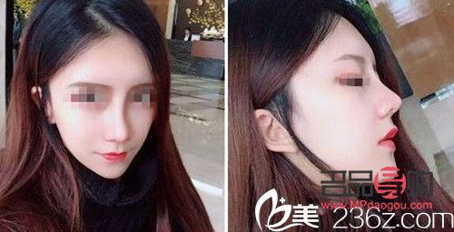 怎么美容整容(怎么美容整容好看)