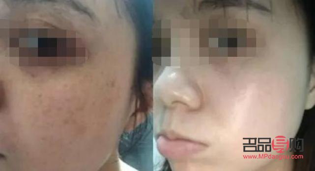 哪家美容效果好(哪家美容效果好点)