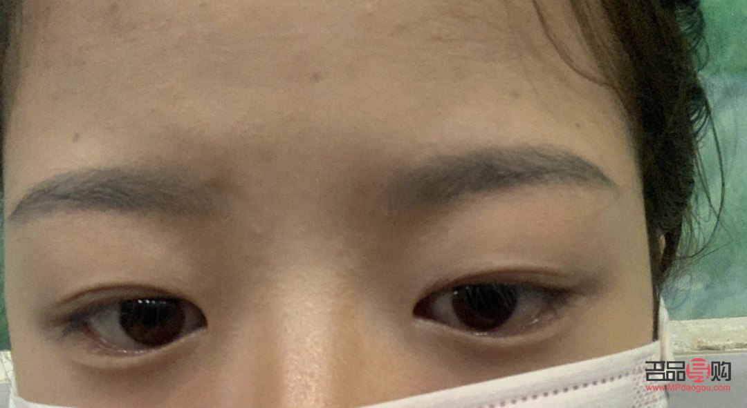 <h3>肿眼泡是怎么回事？</h3>