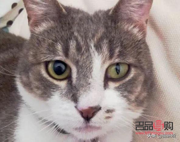 眼睛一大一小正常吗(人的眼睛一大一小正常吗)