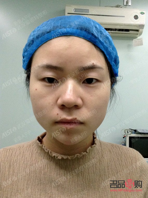 大眼综合和小眼综合哪个好看(大眼综合和小眼综合哪个好看点)