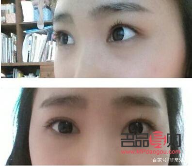 大眼综合和小眼综合哪个好看(大眼综合和小眼综合哪个好看点)