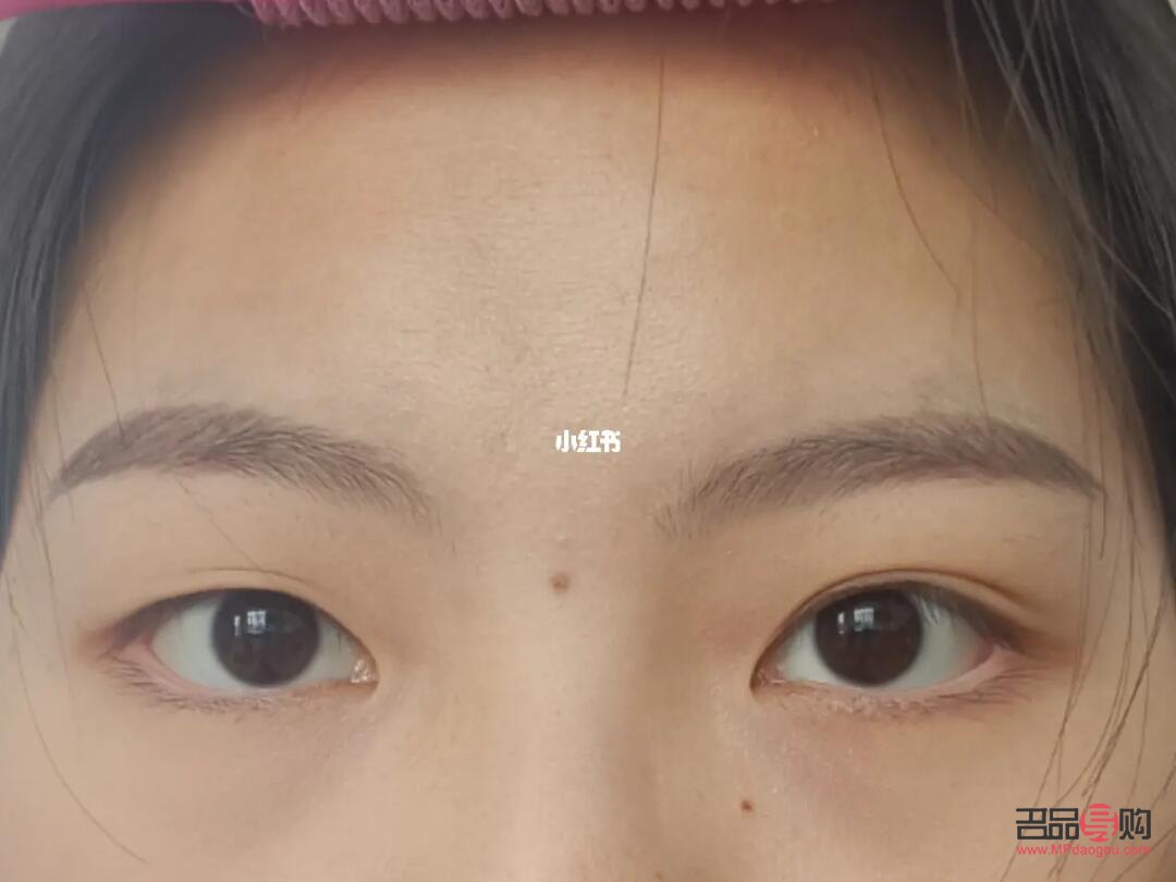 天生一单一双眼皮怎么办(天生一只双眼皮一只单眼皮怎么办)