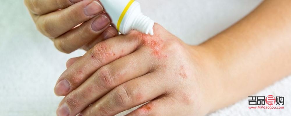 身体上长湿疹怎么护理(身体长湿疹怎么调理)