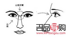 男人眼泡浮肿的面相(男人眼泡浮肿的面相图解)