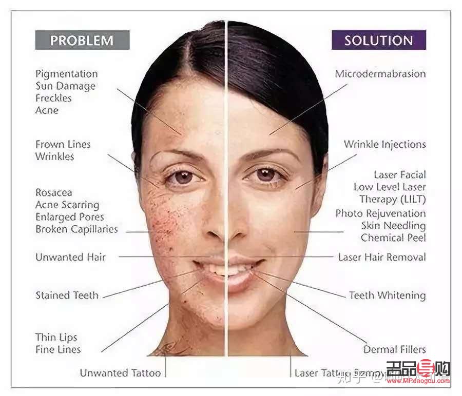 <h3>眼部抗衰对比图揭示的保养秘诀</h3> <h3>眼部抗衰对比图揭示的保养秘诀</h3>