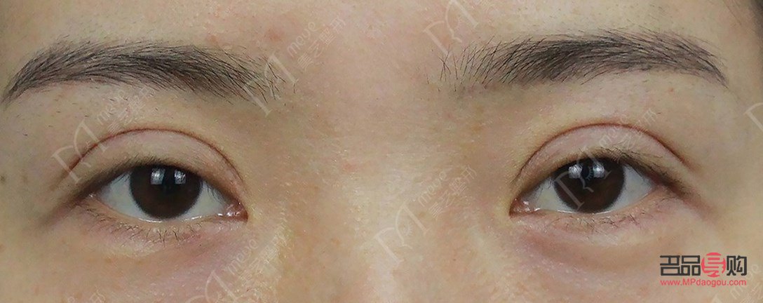 扇形双眼皮给人的感觉(扇形双眼皮给人的感觉怎么样)