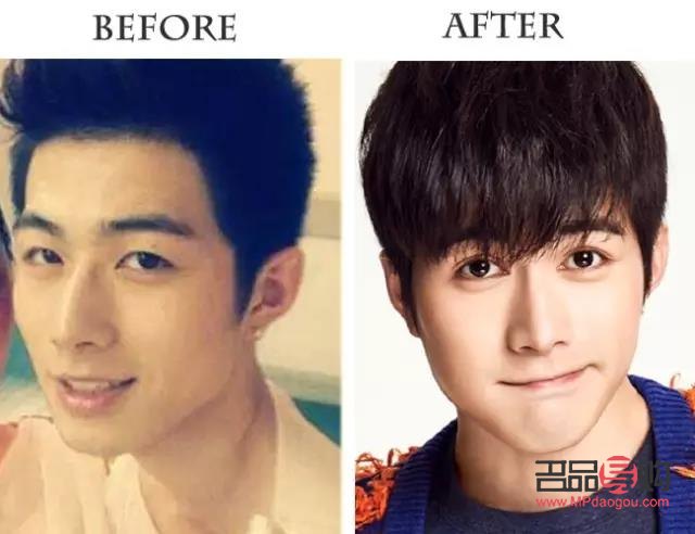 男的割双眼皮多吗(男的割双眼皮多吗知乎)