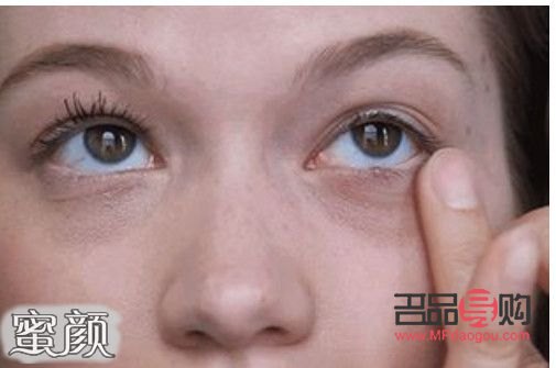 <h3>安全有效除眼袋,这些方法值得一试</h3> <h3>安全有效除眼袋,这些方法值得一试</h3>