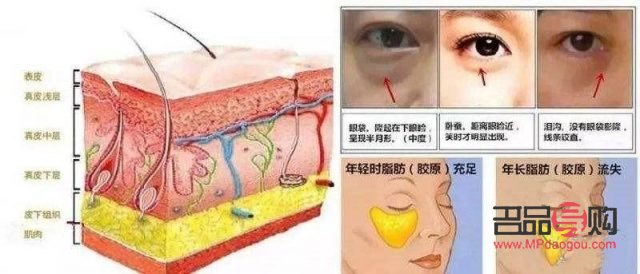 <h3>探究眼袋成因及治疗方法</h3>