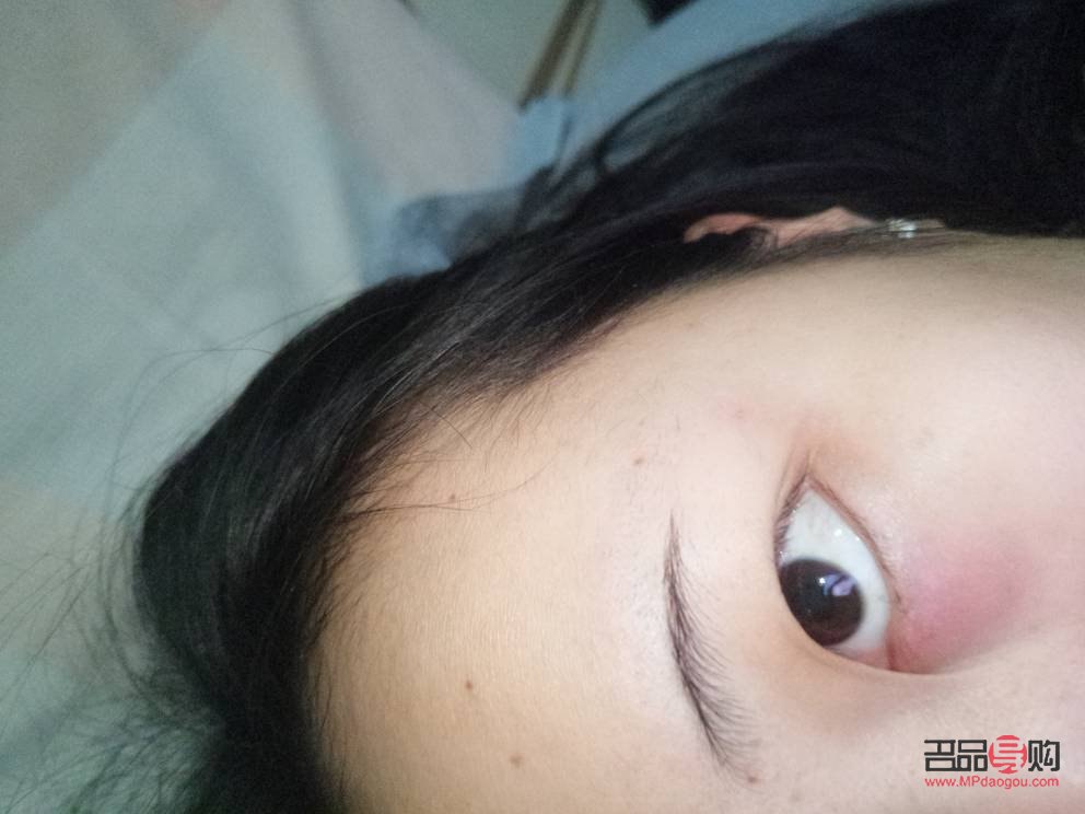 眼睛下面红肿疼是什么原因(眼睛下面红肿疼是什么原因引起的)